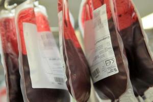 Ko reikia norint paaukoti kraują donorystei: pasiruošimas, procedūra, privilegijos ir įsipareigojimai